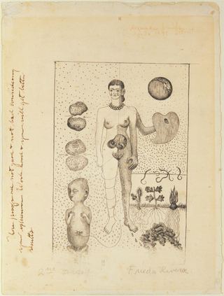Фрида и выкидыш, 1932