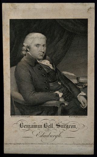 Бенджамин Белл. Линейная гравюра У. и Дж. Уокеров, 1791 г., по мотивам Х. Реберна.