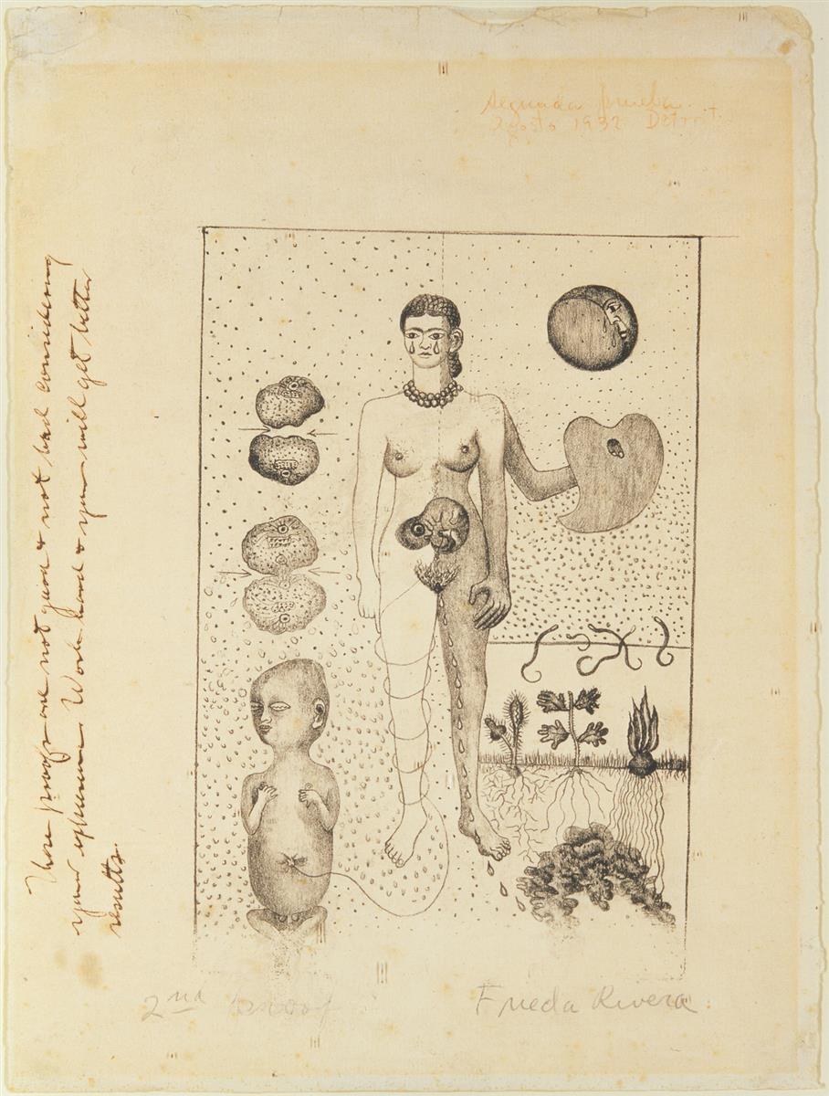 Фрида и выкидыш, 1932